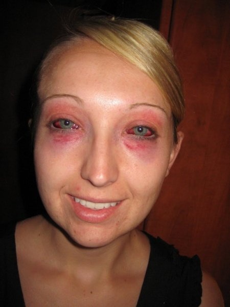 Перцовый баллончик для самообороны, выбор и применение